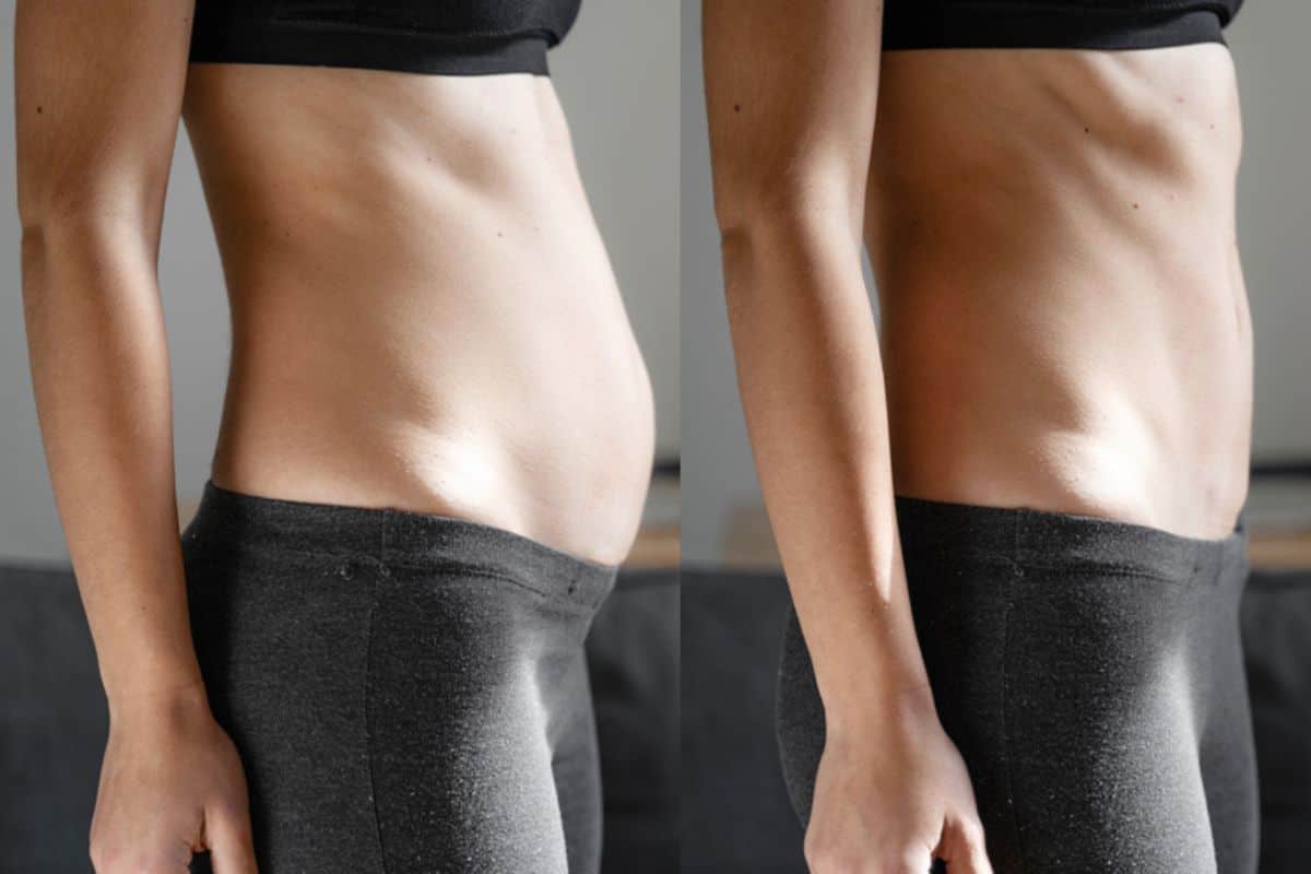 Post-Pregnancy: What Happens to Your Abdominal Muscles After Birth Kilburn