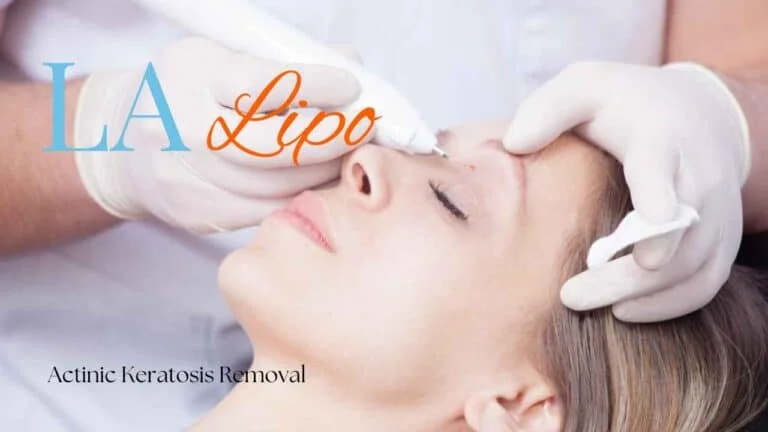Woman receiving Actinic Keratosis Removal Treatment Kilburn