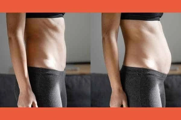 LA-EMS Body Sculpting results Kilburn