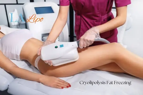 Woman receiving coolsculpting Kilburn treatment on her thighs