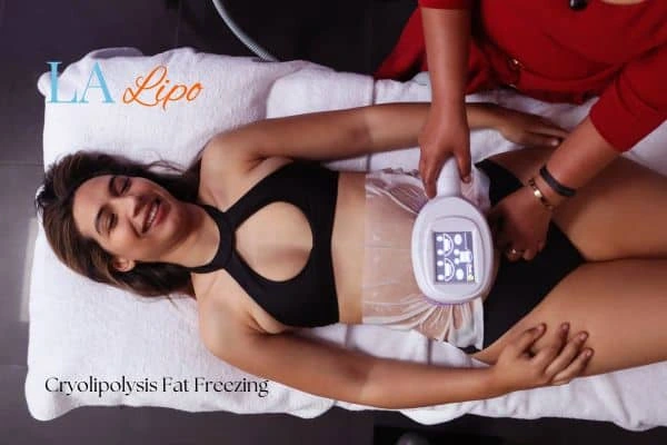 woman getting cryolipolysis Kilburn