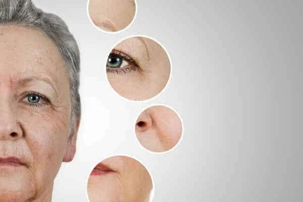 HIFU Facelift Kilburn from LA LIPO