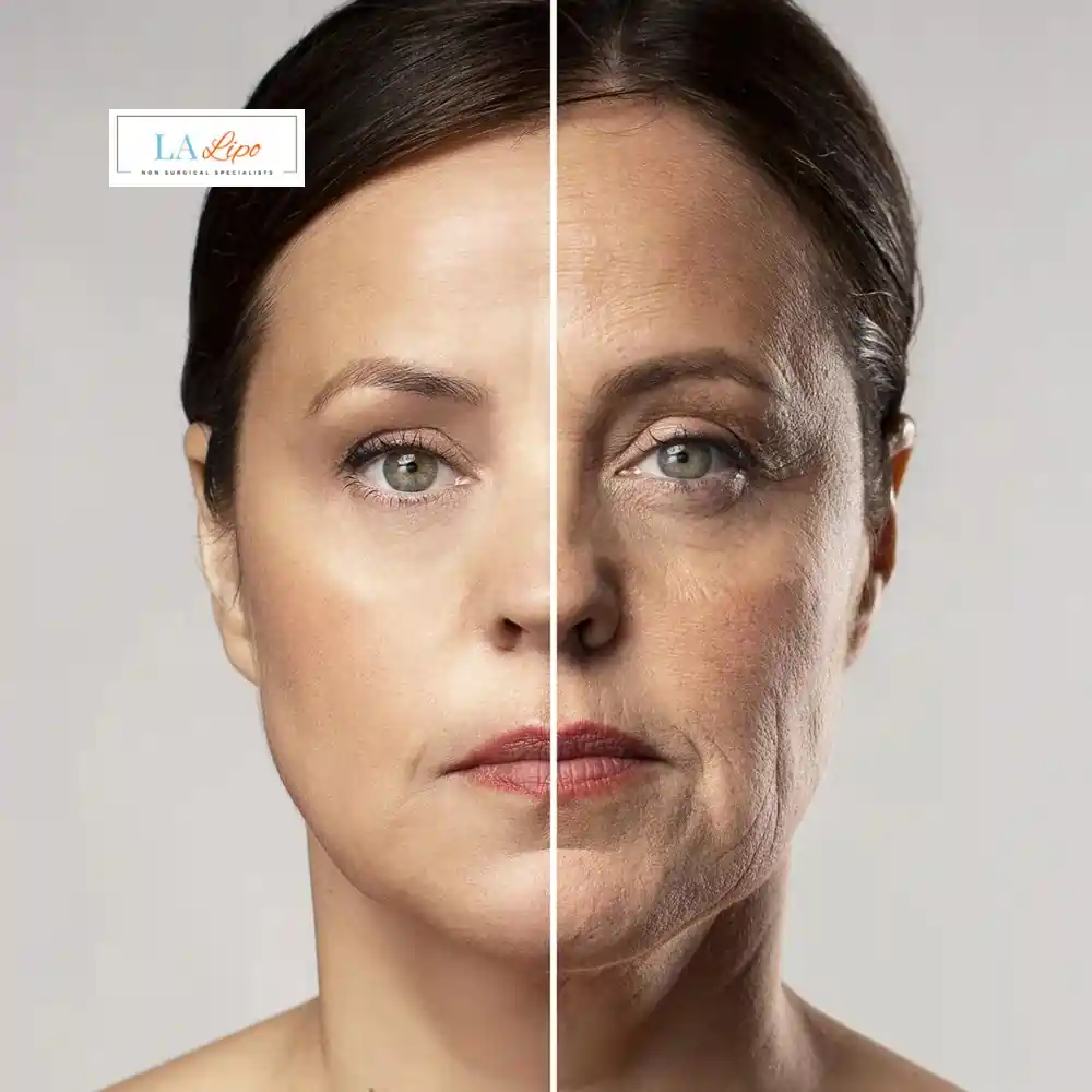 How Can You Tell If Non-Surgical Skin Tightening Is Right for You Kilburn?