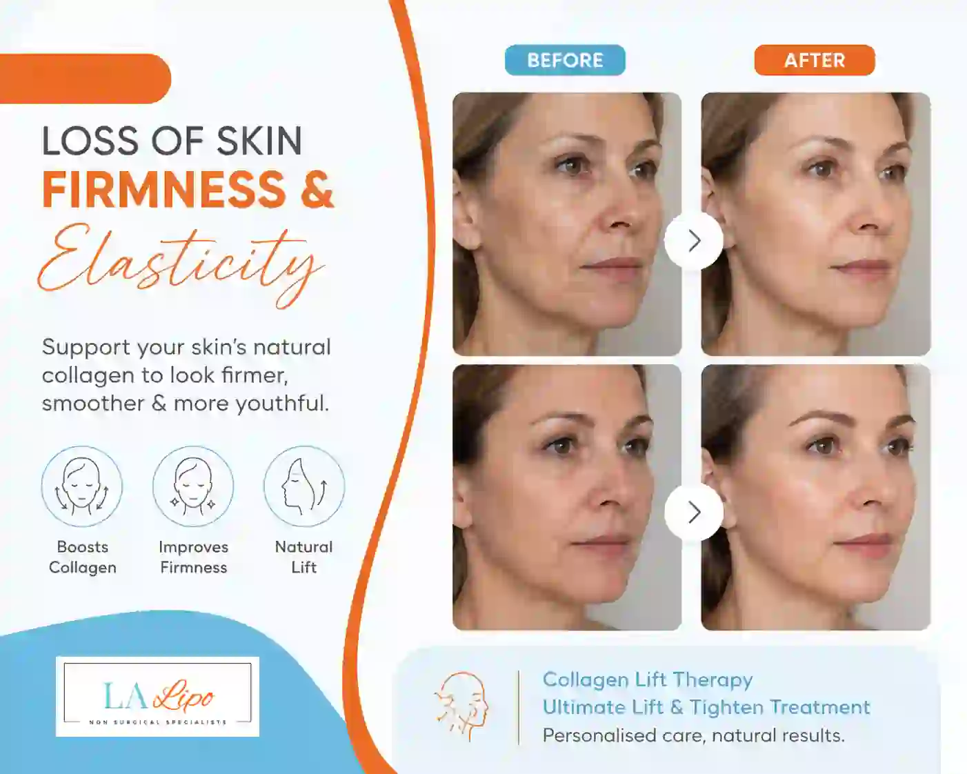Sign #7: Loss of Skin Firmness and Elasticity Kilburn
