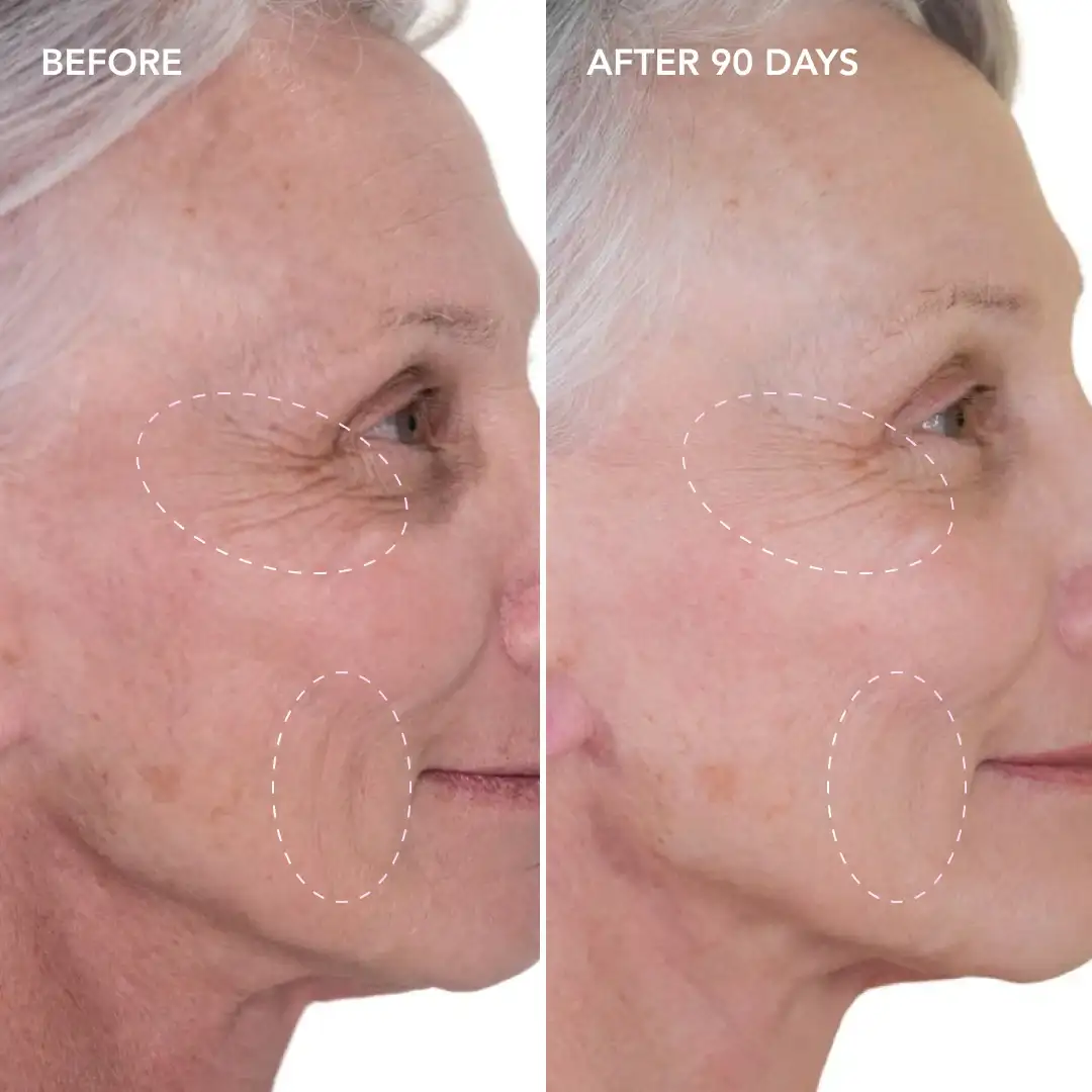 When will you see results Kilburn